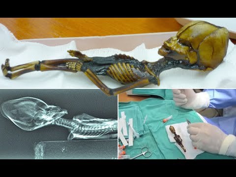 Atacama Humanoid: Extraterrestrial Evidence or Scientific Anomaly ? -UFO LORE
