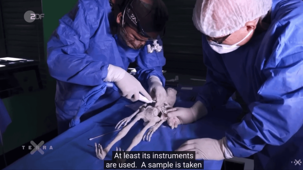 Nazca Mummies (VIDEO - FEB 2021): abdominal tissue biopsy performed on the Tridactyl Humanoid Specimen named "Luisa". It has eggs, but no genitals