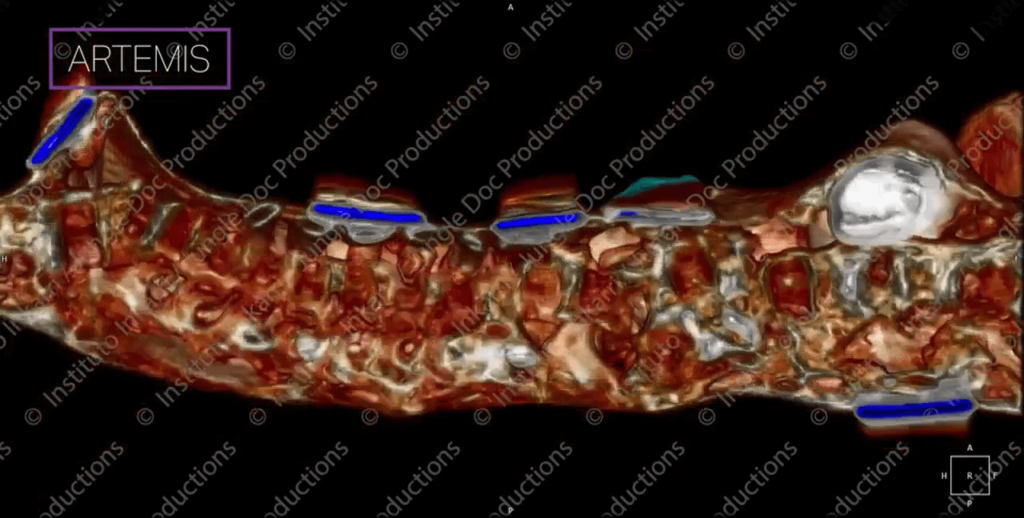 “Nazca Mummies (VIDEO): Inkari Institute unveils new CT-scans of tridactyl reptile-humanoid specimen "Artemis"”