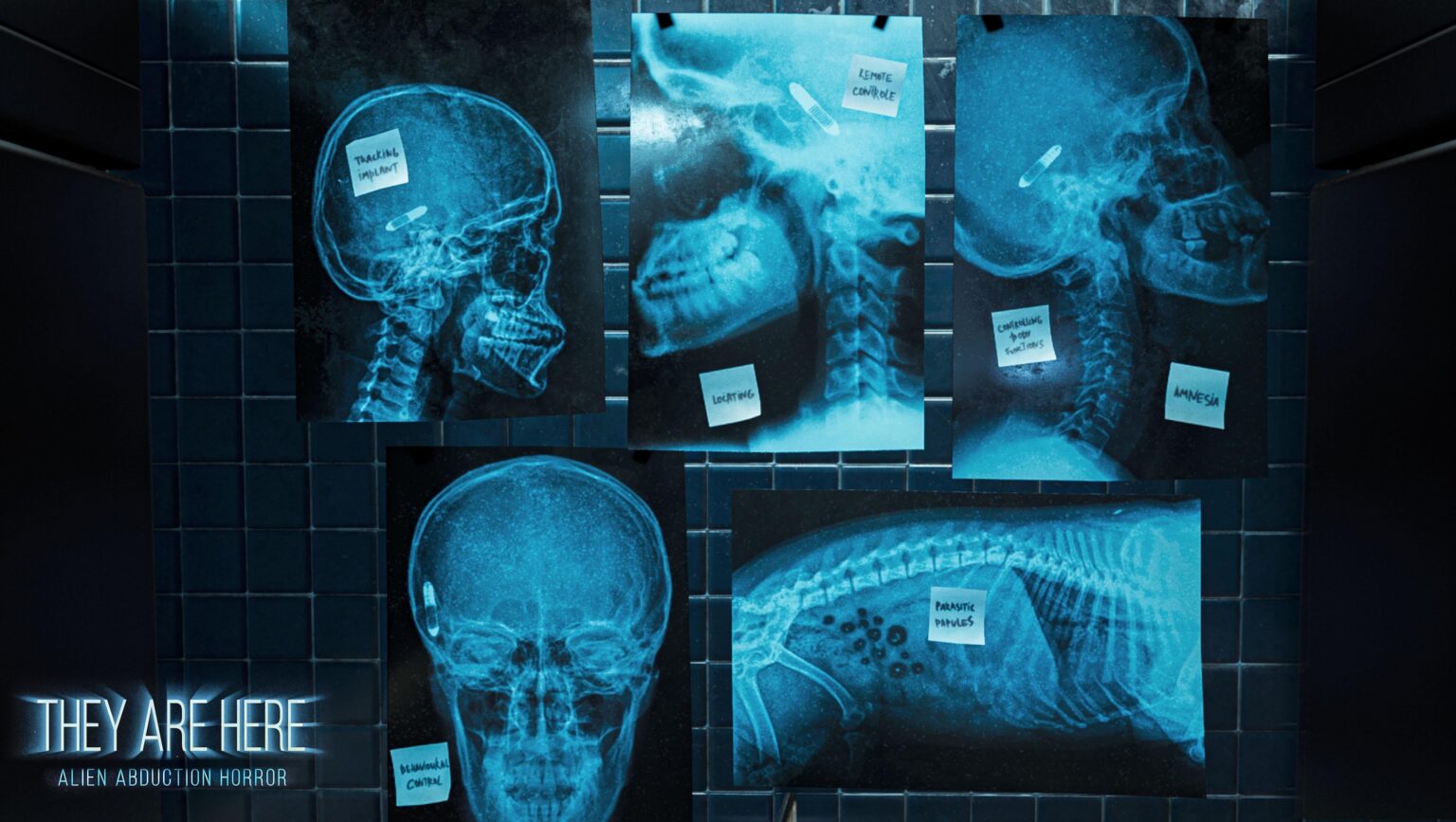 These are the x-rays with the implant I made for the alien abduction horror game They Are Here. Does it look realistic?