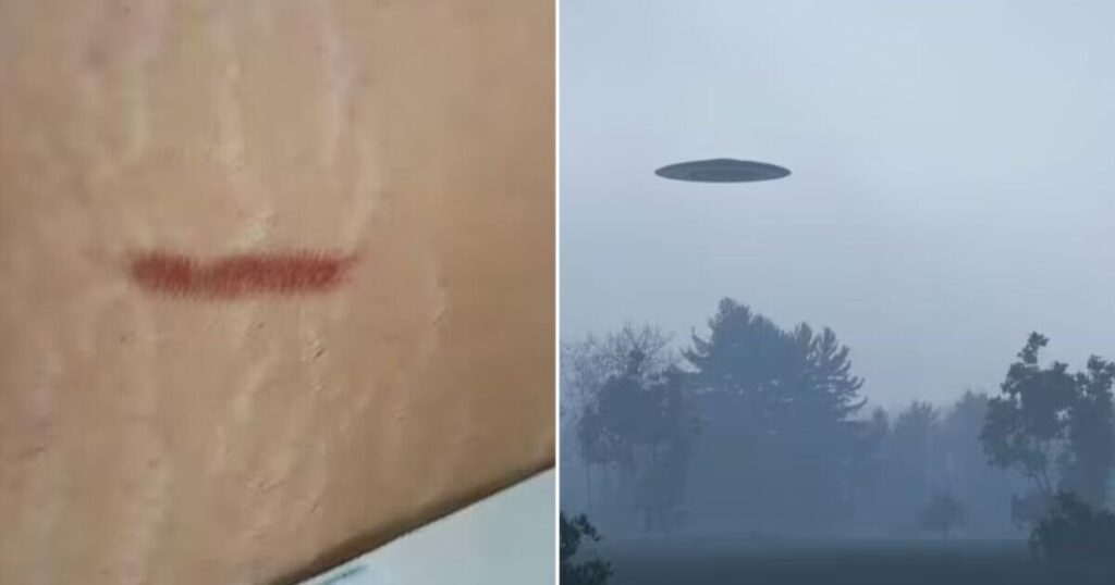 Woman wakes up with horrifying scar on stomach after 'alien encounter'