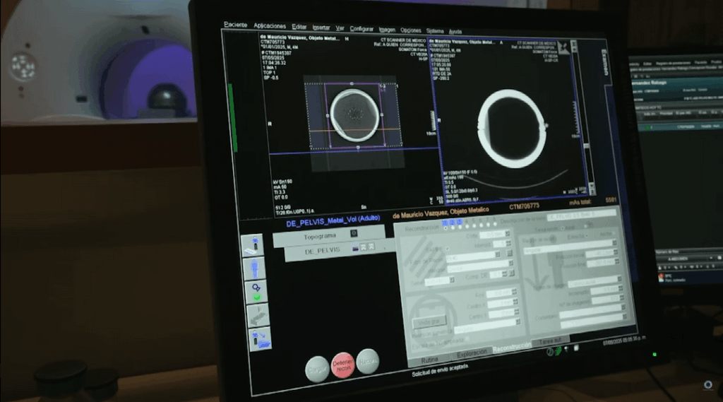 CT Scan of the sphere of Buga, Colombia.