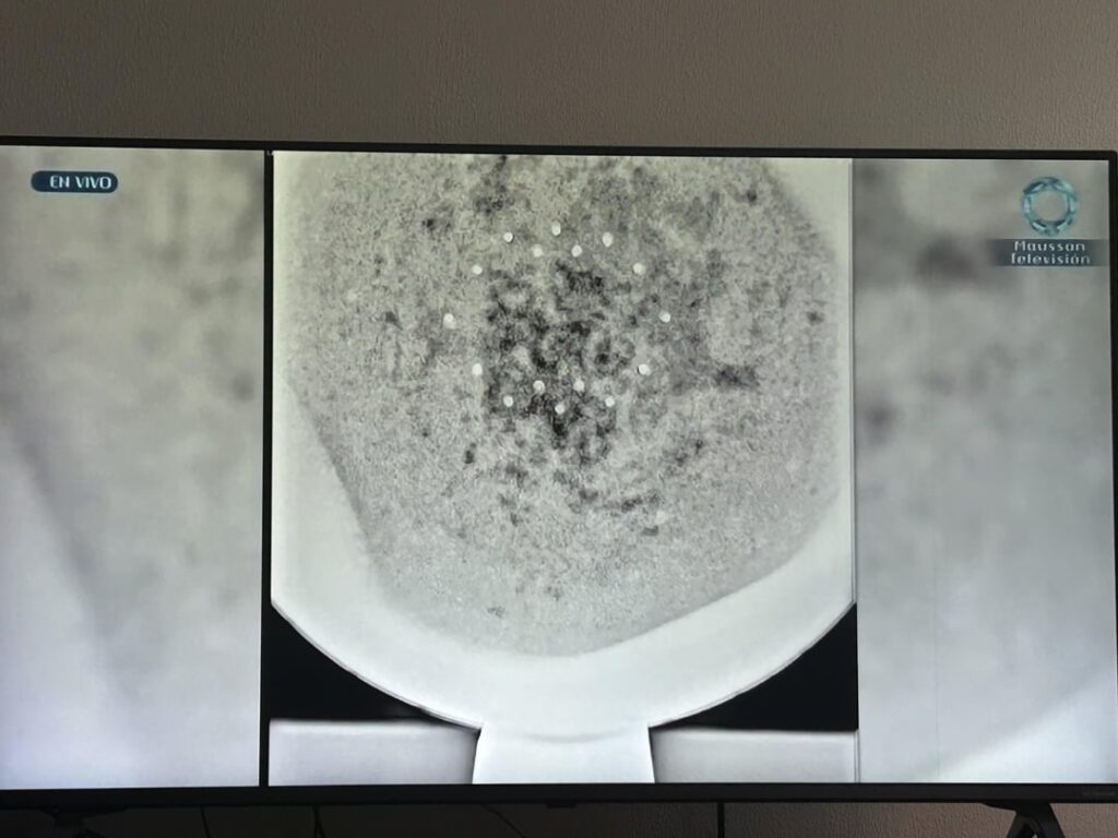 Buga sphere alleged x-ray images