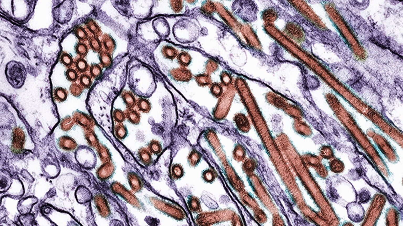 Today's biggest science news: Man dies from H5N5 bird flu | 'Alien' rock on Mars | 'Other' comet ATLAS disintegrating