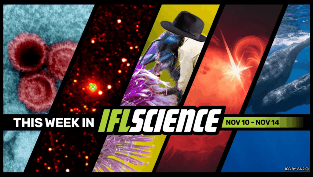 Lupus Linked To Virus That Over 95 Percent Of Us Carry, First Radio Detection Received From Interstellar Object 3I/ATLAS, And Much More This Week Lupus Linked To Virus That Over 95 Percent Of Us Carry, First Radio Detection Received From Interstellar Object 3I/ATLAS, And Much More This Week