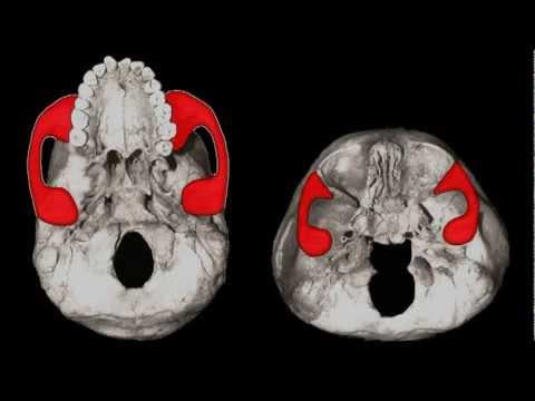 the starchild skulls FOXP2 GENE VARIATION is 56 while humans are 0 this is proof the starchild skull is not human so thats what he explains in the video