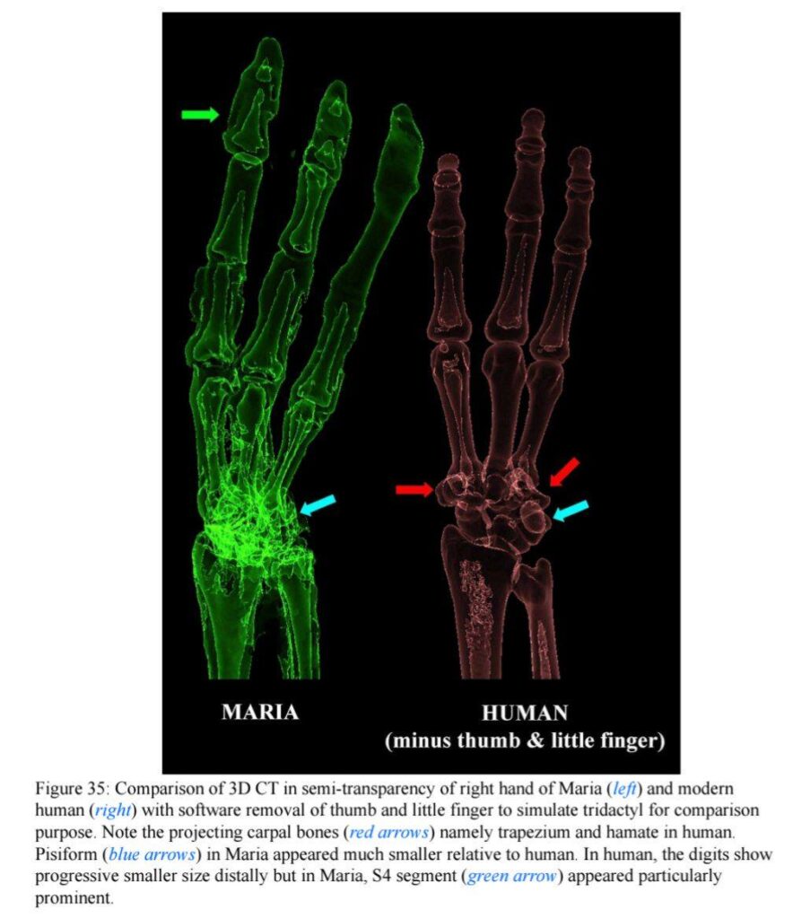 Virtual Autopsy report on Maria, a tridactyl, by Dr. Fung