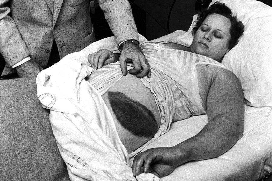 In 1954, Ann Hodges was napping on her couch inside her Alabama home when a grapefruit-sized meteorite crashed through her roof, bounced off her radio, and struck her side. The impact left her bruised but alive. She is the only recorded person in history to have been struck by a meteorite.