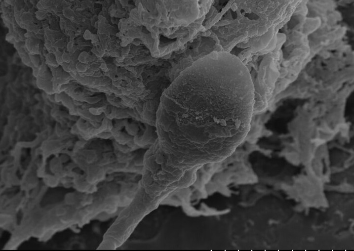 A grayscale 3D electron microscope image of a sperm attached to a spongy surface