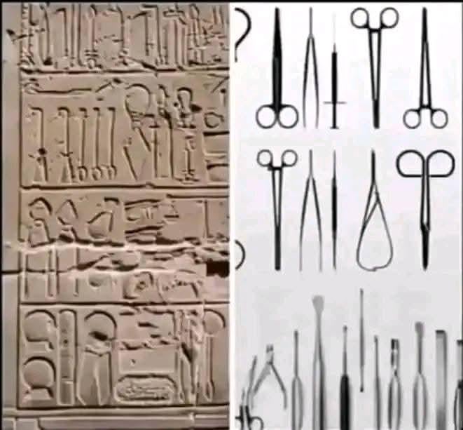 Modern Medicine is Just a Remake: The 3000-Year-Old Surgical Kit That Proves We Aren’t as Advanced as We Think