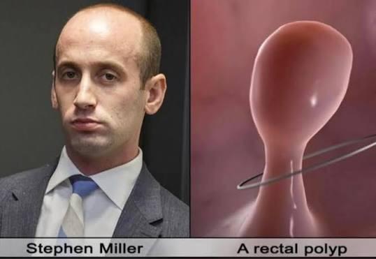 What if, instead of going into politics, White House deputy chief of staff Stephen Miller decided to become a Hollywood actor starring in his breakout role as a rectal polyp?