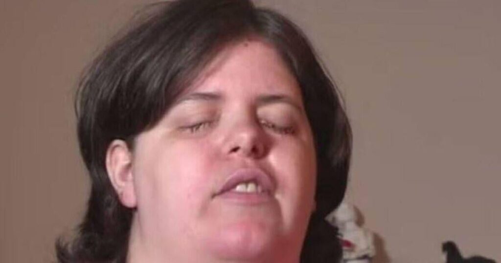 'I blinded myself with drain cleaner after dreaming of losing my sight as a child'