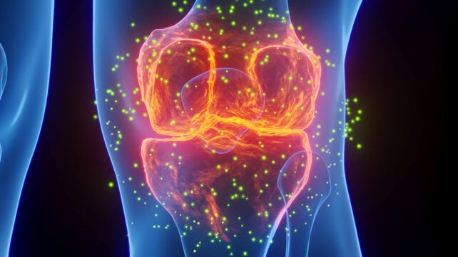Inflamed knee