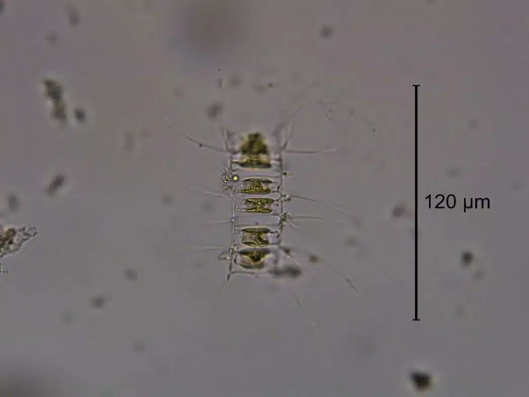 Microscopic View Of A Diatom Chain, A Type Of Phytoplankton Commonly Found In Ocean Blooms.